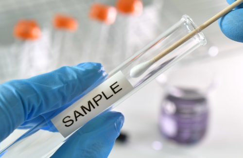 Testing swab being inserted test tube labeled sample, positive, negative, results, lab science